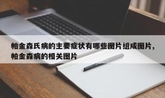 帕金森氏病的主要症状有哪些图片组成图片,帕金森病的相关图片