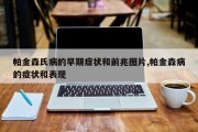 帕金森氏病的早期症状和前兆图片,帕金森病的症状和表现
