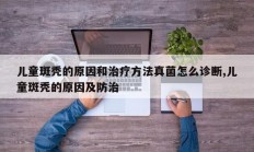 儿童斑秃的原因和治疗方法真菌怎么诊断,儿童斑秃的原因及防治