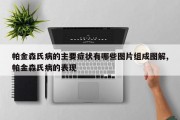 帕金森氏病的主要症状有哪些图片组成图解,帕金森氏病的表现