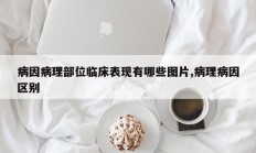 病因病理部位临床表现有哪些图片,病理病因区别
