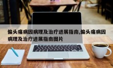 偏头痛病因病理及治疗进展指南,偏头痛病因病理及治疗进展指南图片