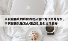 手腕腱鞘炎的症状表现及治疗方法图片分析,手腕腱鞘炎是怎么引起的,怎么治疗最好