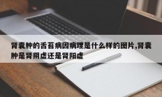肾囊肿的舌苔病因病理是什么样的图片,肾囊肿是肾阴虚还是肾阳虚