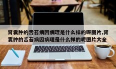 肾囊肿的舌苔病因病理是什么样的呢图片,肾囊肿的舌苔病因病理是什么样的呢图片大全