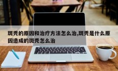 斑秃的原因和治疗方法怎么治,斑秃是什么原因造成的斑秃怎么治