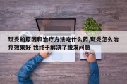 斑秃的原因和治疗方法吃什么药,斑秃怎么治疗效果好 我终于解决了脱发问题