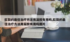 肛裂的最佳治疗方法用凝胶有用吗,肛裂的最佳治疗方法用凝胶有用吗图片
