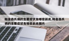 帕金森氏病的主要症状有哪些前兆,帕金森氏病的主要症状有哪些前兆图片