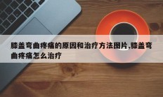 膝盖弯曲疼痛的原因和治疗方法图片,膝盖弯曲疼痛怎么治疗