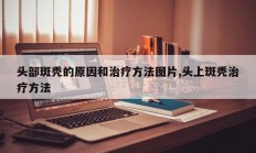 头部斑秃的原因和治疗方法图片,头上斑秃治疗方法