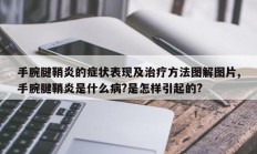 手腕腱鞘炎的症状表现及治疗方法图解图片,手腕腱鞘炎是什么病?是怎样引起的?