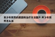 青少年斑秃的原因和治疗方法图片,青少年斑秃怎么治