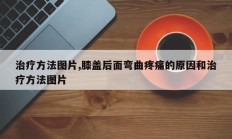 治疗方法图片,膝盖后面弯曲疼痛的原因和治疗方法图片