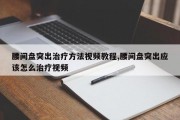腰间盘突出治疗 *** 视频教程,腰间盘突出应该怎么治疗视频