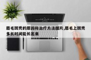 眉毛斑秃的原因和治疗方法图片,眉毛上斑秃多长时间能长出来