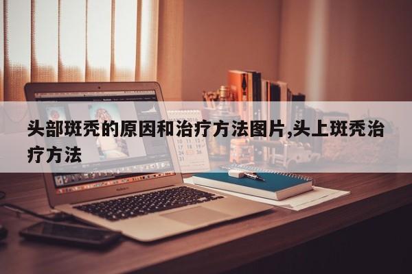 头部斑秃的原因和治疗方法图片,头上斑秃治疗方法